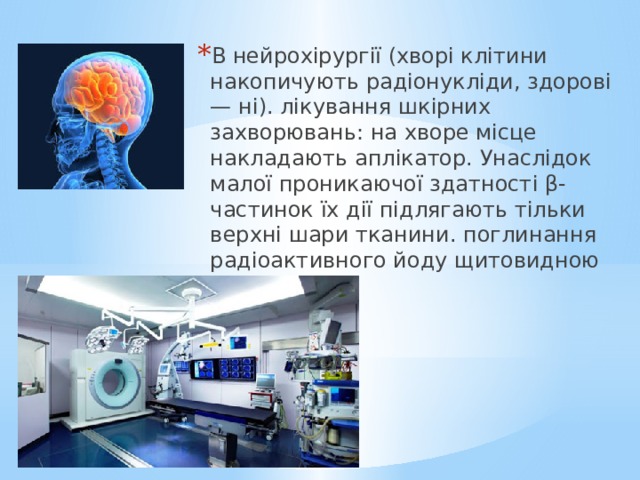 В нейрохірургії (хворі клітини накопичують радіонукліди, здорові — ні). лікування шкірних захворювань: на хворе місце накладають аплікатор. Унаслідок малої проникаючої здатності β-частинок їх дії підлягають тільки верхні шари тканини. поглинання радіоактивного йоду щитовидною залозою. 