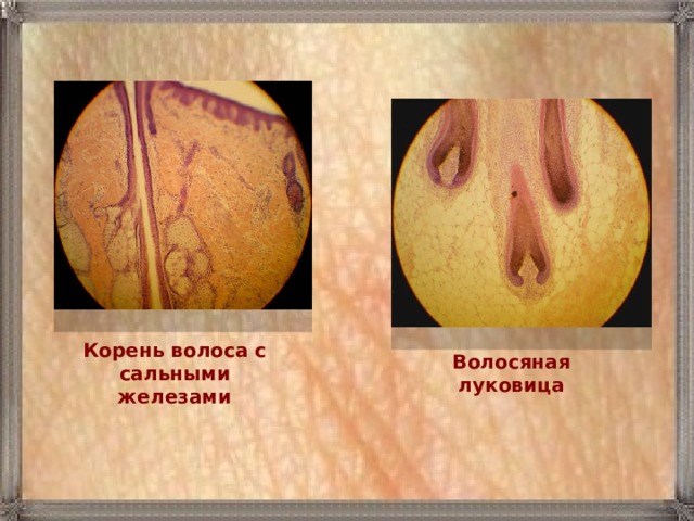 Корень волоса с сальными железами Волосяная луковица 