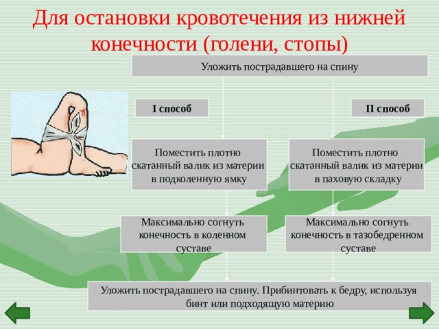 Последовательность остановки кровотечения