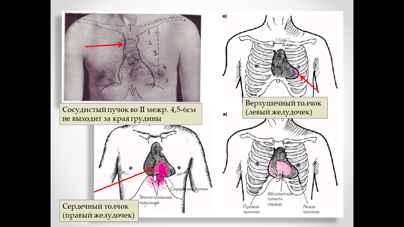 Сосудистый пучок. Перкуссия сердца границы сосудистого пучка. Ширина сосудистого пучка во 2 межреберье. Перкуссия сердца верхушечный толчок.