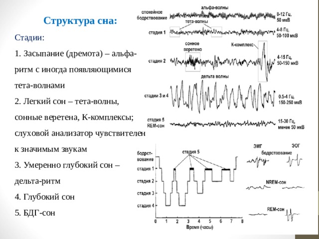 Нарушения альфа ритмов. Сонные веретена. 1 И 2 стадия сна регистрировалась тета. Сонные веретена дремота Дельта сон что это.