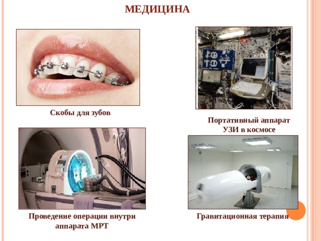 МЕДИЦИНА Скобы для зубов Портативный аппарат УЗИ в космосе Проведение операции внутри аппарата МРТ Гравитационная терапия 