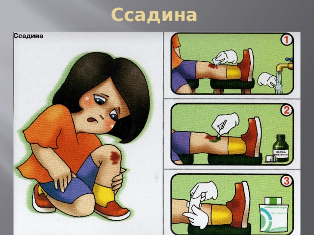 Ссадина 