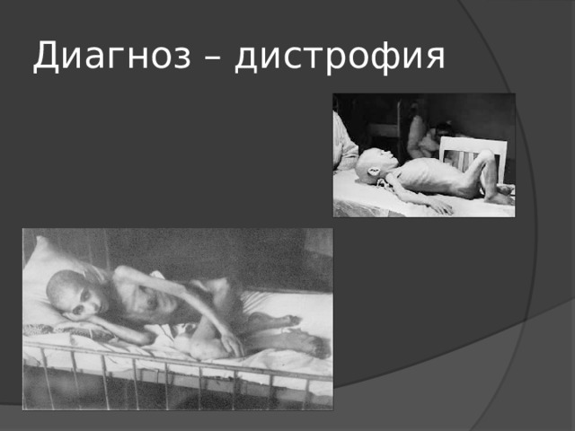 Диагноз – дистрофия 