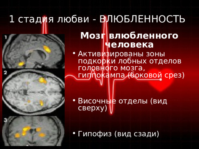 1 стадия любви - ВЛЮБЛЕННОСТЬ Мозг влюбленного человека Активизированы зоны подкорки лобных отделов головного мозга, гиппокампа (боковой срез) Височные отделы (вид сверху) Гипофиз (вид сзади) 