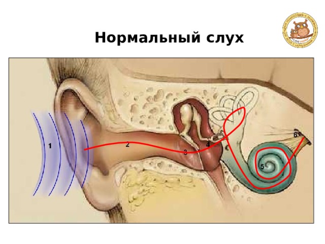 Нормальный слух 