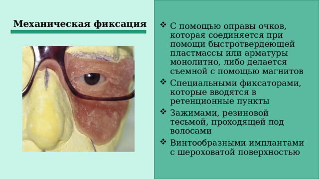 Механическая фиксация С помощью оправы очков, которая соединяется при помощи быстротвердеющей пластмассы или арматуры монолитно, либо делается съемной с помощью магнитов Специальными фиксаторами, которые вводятся в ретенционные пункты Зажимами, резиновой тесьмой, проходящей под волосами Винтообразными имплантами с шероховатой поверхностью 