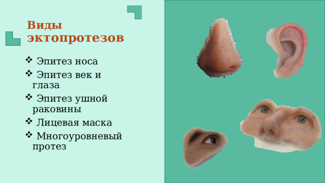 Виды эктопротезов  Эпитез носа  Эпитез век и глаза  Эпитез ушной раковины  Лицевая маска  Многоуровневый протез 