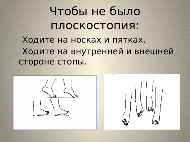 Чтобы не было плоскостопия:  Ходите на носках и пятках.  Ходите на внутренней и внешней стороне стопы. 