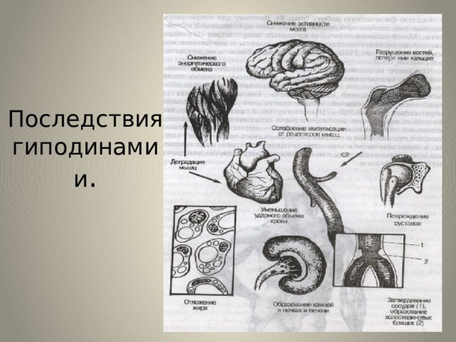Последствия гиподинамии . 