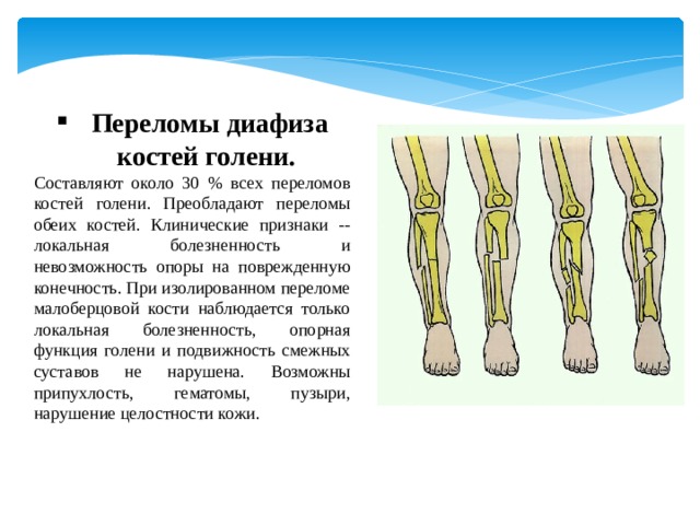 Переломы голени презентация