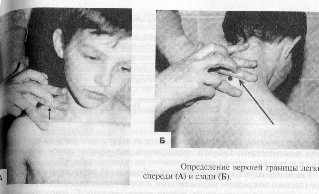 Норма высота стояния легких. Ширина полей Кренига перкуссия. Методика определения поля Кренига. Измерения ширины полей Кренига. Ширина полей Кренига у детей.