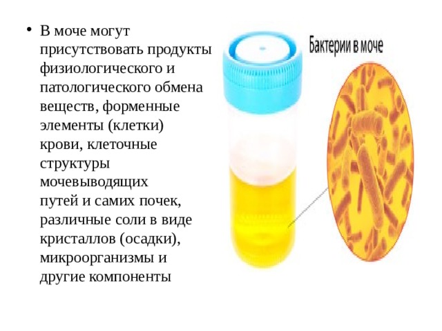 В моче могут присутствовать продукты  физиологического и патологического обмена  веществ, форменные элементы (клетки)  крови, клеточные структуры мочевыводящих  путей и самих почек, различные соли в виде  кристаллов (осадки), микроорганизмы и  другие компоненты 