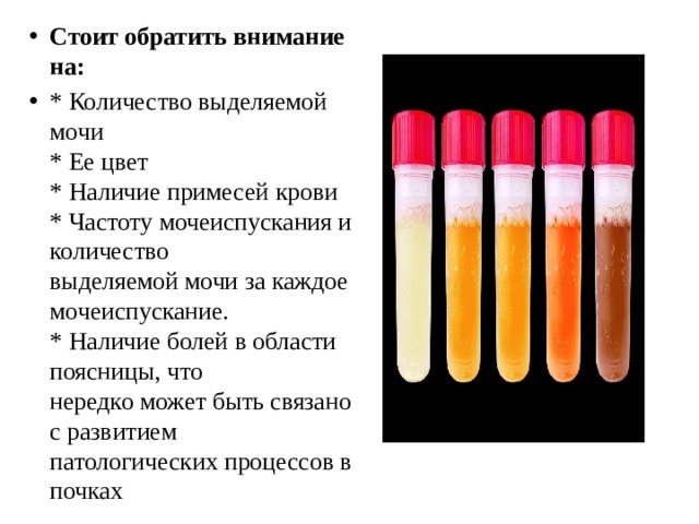 Стоит обратить внимание на: * Количество выделяемой мочи  * Ее цвет  * Наличие примесей крови  * Частоту мочеиспускания и количество  выделяемой мочи за каждое мочеиспускание.  * Наличие болей в области поясницы, что  нередко может быть связано с развитием  патологических процессов в почках 