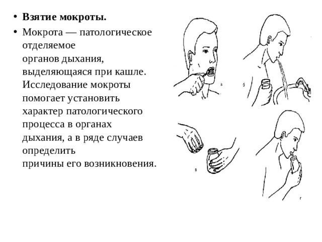 Взятие мокроты. Мокрота — патологическое отделяемое  органов дыхания, выделяющаяся при кашле.  Исследование мокроты помогает установить  характер патологического процесса в органах  дыхания, а в ряде случаев определить  причины его возникновения. 