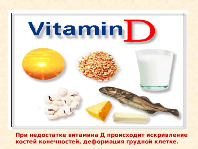 При недостатке витамина Д происходит искривление костей конечностей, деформация грудной клетке. 