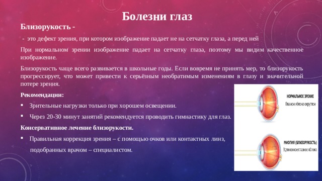 Глаз как оптическая система дефекты зрения и способы их исправления презентация