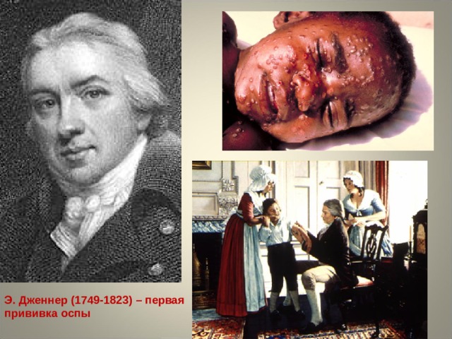 Э. Дженнер (1749-1823) – первая прививка оспы 