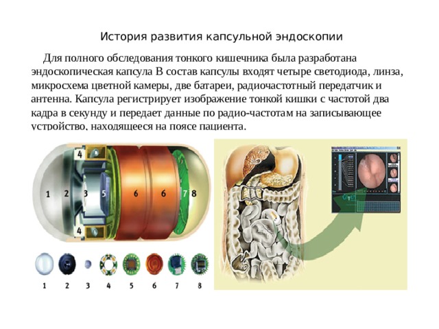 Капсульная эндоскопия презентация