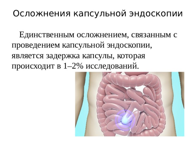 Капсульная эндоскопия презентация