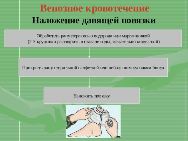 Венозное кровотечение Наложение давящей повязки Обработать рану перекисью водорода или марганцовкой  (2-3 крупинки растворить в стакане воды, желательно кипяченой) Прикрыть рану стерильной салфеткой или небольшим кусочком бинта Наложить повязку 