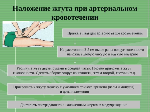 Наложение жгута при артериальном кровотечении Прижать пальцем артерию выше кровотечения На расстоянии 3-5 см выше раны вокруг конечности наложить любую чистую и мягкую материю Растянуть жгут двумя руками в средней части. Плотно приложить жгут к конечности. Сделать оборот вокруг конечности, затем второй, третий и т.д. Прикрепить к жгуту записку с указанием точного времени (часы и минуты) и даты наложения Доставить пострадавшего с наложенным жгутом в медучреждение 