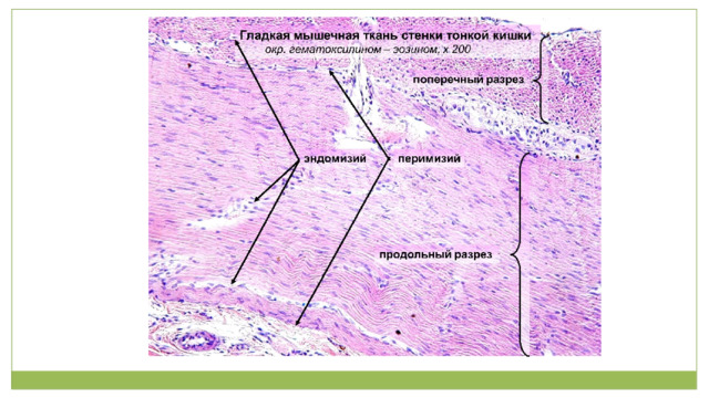 Миокард рисунок по гистологии