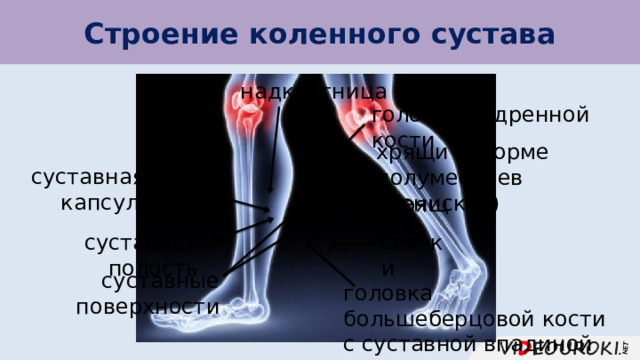 Строение коленного сустава надкостница головка бедренной кости хрящи в форме полумесяцев (менисков) суставная капсула хрящ суставная полость связки суставные поверхности головка большеберцовой кости с суставной впадиной 