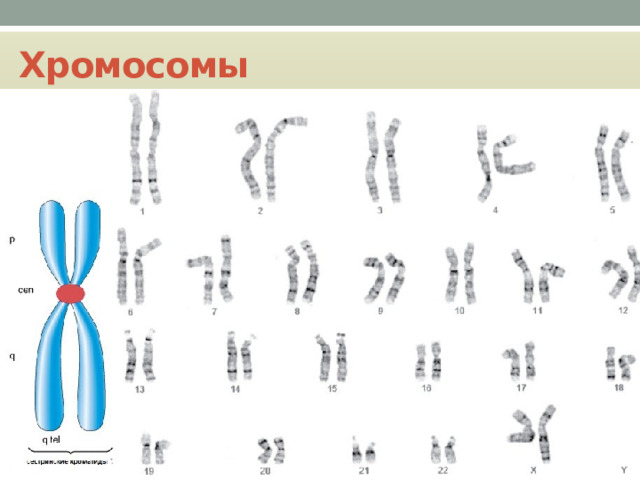 Хромосомы 