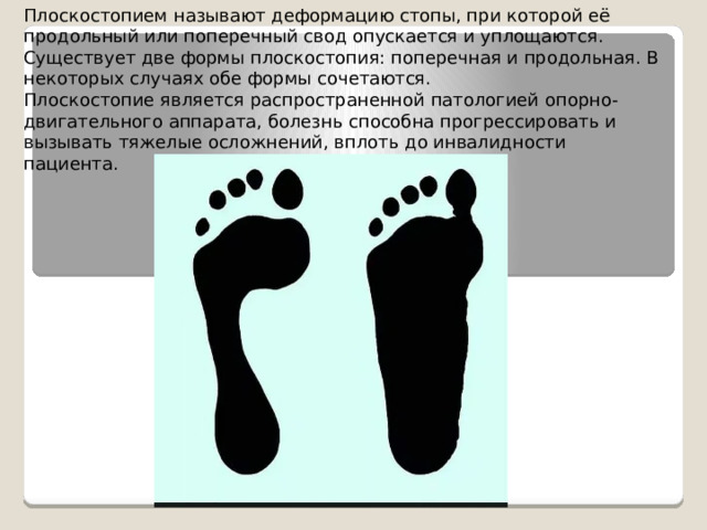 Лабораторная работа по биологии плоскостопие. Выявление плоскостопия вывод. Проба на плоскостопие. Статистика плоскостопия у детей.