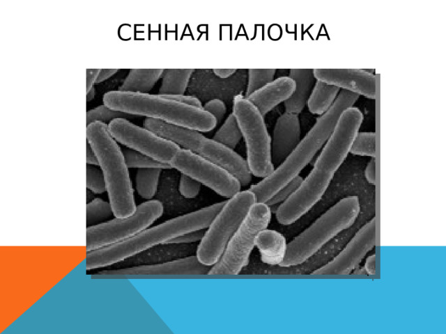 сенная палочка Знакомство с особенностями строения бактерий начнем с изучения сенной палочки. Рассмотрев микропрепараты под микроскопом, можно сделать вывод:  бактерия — всего одна палочковидная клетка с тонкой оболочкой и цитоплазмой. Типичного ядра в цитоплазме нет. Чтобы расширить представления об особенностях строения бактерий, научиться определять их формы и особенности объединения клеток необходимо поработать с текстом учебника, слайдами презентации.  