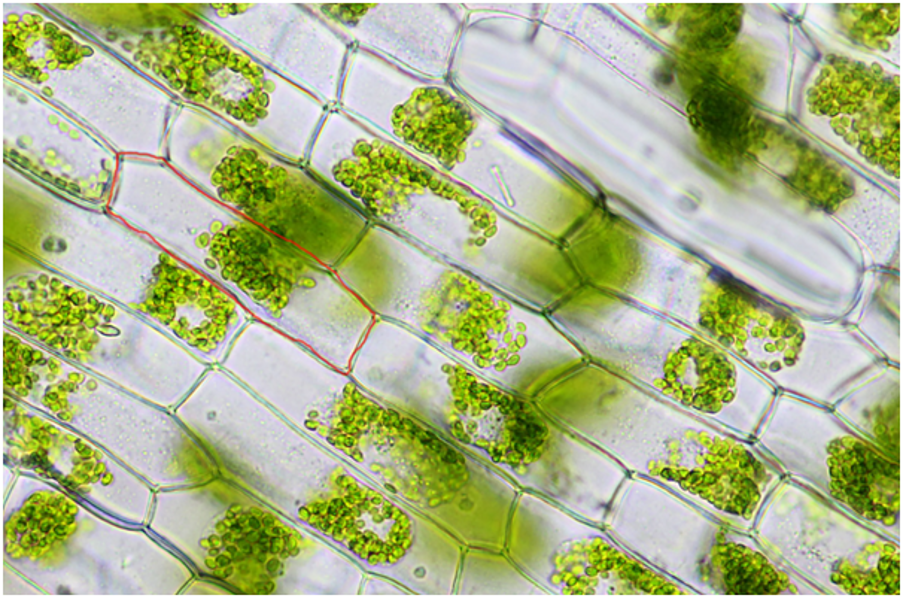 Зеленый расширяет. Элодея хлорофилл. Клетки фотосинтезирующей ткани элодеи. Фотосинтезирующая ткань хлоропласты. Фотосинтезирующая ткань листа под микроскопом.