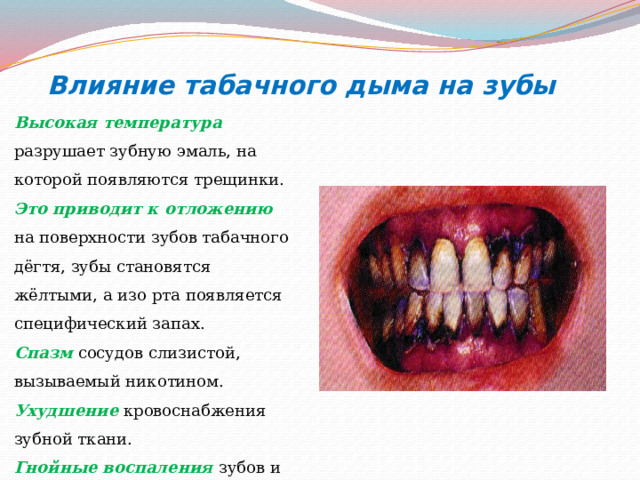  Влияние табачного дыма на зубы Высокая температура разрушает зубную эмаль, на которой появляются трещинки. Это приводит к отложению на поверхности зубов табачного дёгтя, зубы становятся жёлтыми, а изо рта появляется специфический запах. Спазм сосудов слизистой, вызываемый никотином. Ухудшение  кровоснабжения зубной ткани. Гнойные воспаления зубов и другие. 