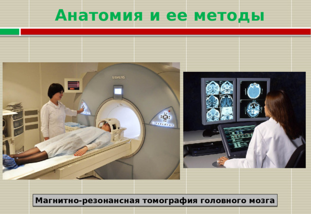 Анатомия и ее методы Магнитно-резонансная томография головного мозга 