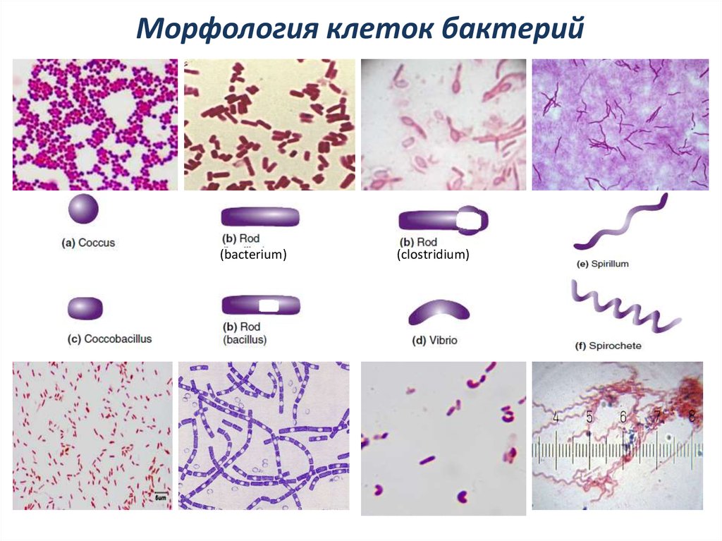 Рисунок морфология бактерий