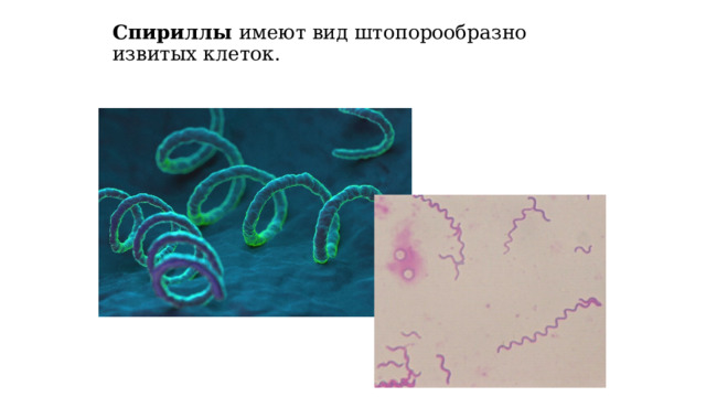 Спириллы имеют вид штопорообразно извитых клеток. 