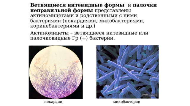 Актиномицеты морфология. Нитевидные бактерии. Актиномицеты систематика.