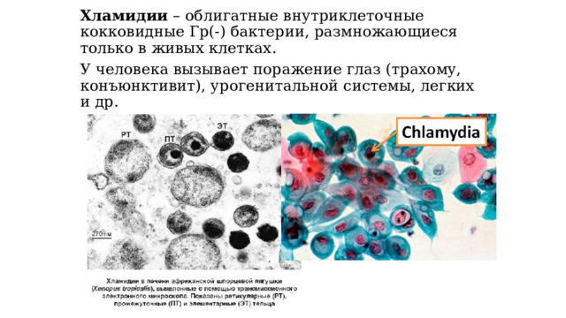 Хламидии – облигатные внутриклеточные кокковидные Гр(-) бактерии, размножающиеся только в живых клетках. У человека вызывает поражение глаз (трахому, конъюнктивит), урогенитальной системы, легких и др. 