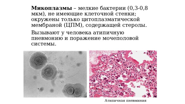 Микоплазмы – мелкие бактерии (0,3-0,8 мкм), не имеющие клеточной стенки; окружены только цитоплазматической мембраной (ЦПМ), содержащей стеролы. Вызывают у человека атипичную пневмонию и поражение мочеполовой системы. Атипичная пневминия 
