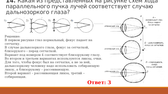 Дальнозорким людям необходимо использовать очки так как у них изображение фокусируется за сетчаткой