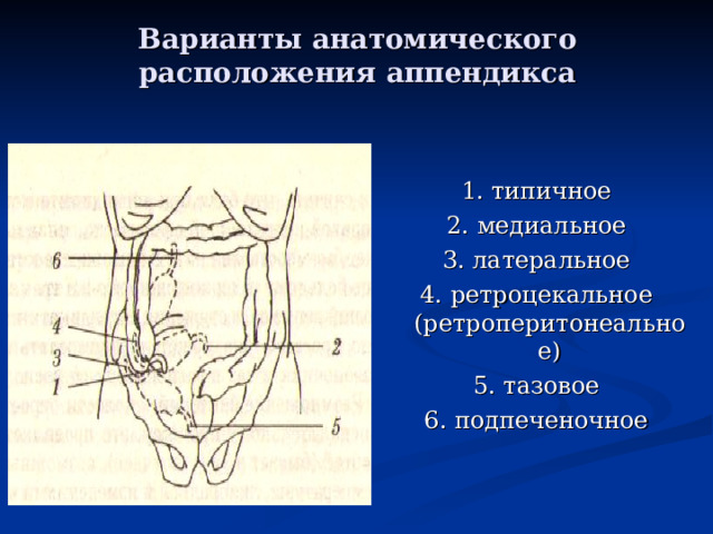 Аппендикс расположение схема