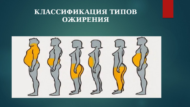 КЛАССИФИКАЦИЯ ТИПОВ ОЖИРЕНИЯ   