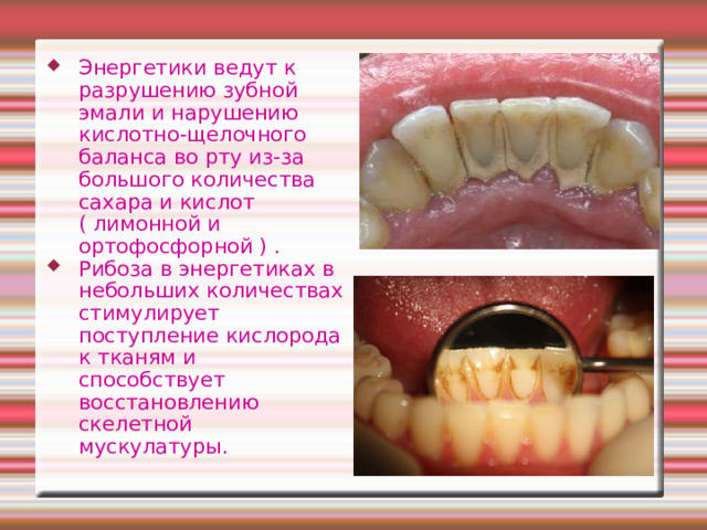Энергетики ведут к разрушению зубной эмали и нарушению кислотно-щелочного баланса во рту из-за большого количества сахара и кислот ( лимонной и ортофосфорной ) . Рибоза в энергетиках в небольших количествах стимулирует поступление кислорода к тканям и способствует восстановлению скелетной мускулатуры. 