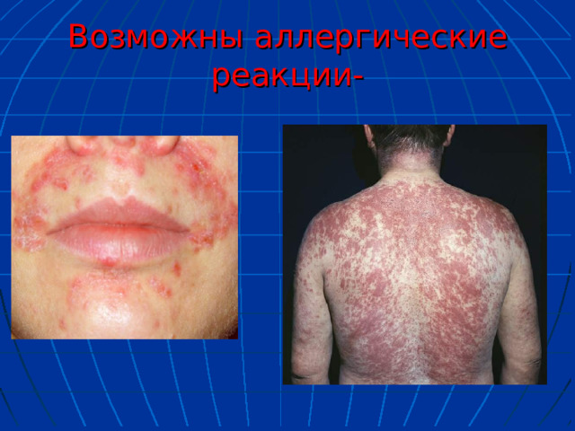 Возможны аллергические реакции- 