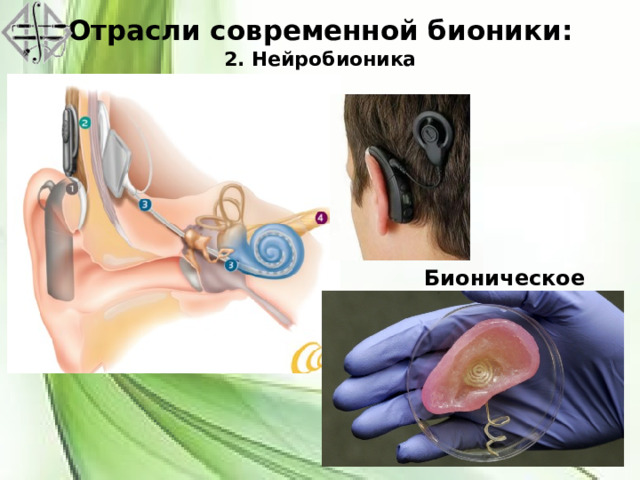 Отрасли современной бионики:  2. Нейробионика Бионическое ухо 