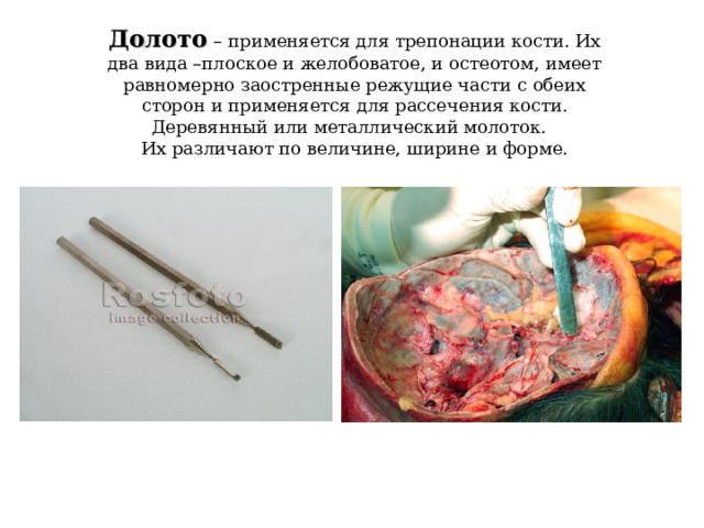 Долото  – применяется для трепонации кости. Их два вида –плоское и желобоватое, и остеотом, имеет равномерно заостренные режущие части с обеих сторон и применяется для рассечения кости. Деревянный или металлический молоток. Их различают по величине, ширине и форме. 