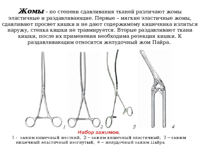 Жомы  – по степени сдавливания тканей различают жомы эластичные и раздавливающие. Первые – мягкие эластичные жомы, сдавливают просвет кишки и не дают содержимому кишечника излиться наружу, стенка кишки не травмируется. Вторые раздавливают ткани кишки, после их применения необходима резекция кишки. К раздавливающим относится желудочный жом Пайра. 