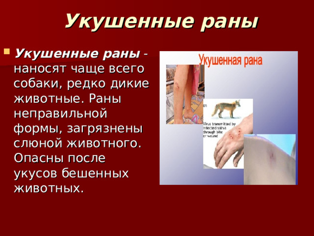 Укушенные раны Укушенные раны  - наносят чаще всего собаки, редко дикие животные. Раны неправильной формы, загрязнены слюной животного. Опасны после укусов бешенных животных. 
