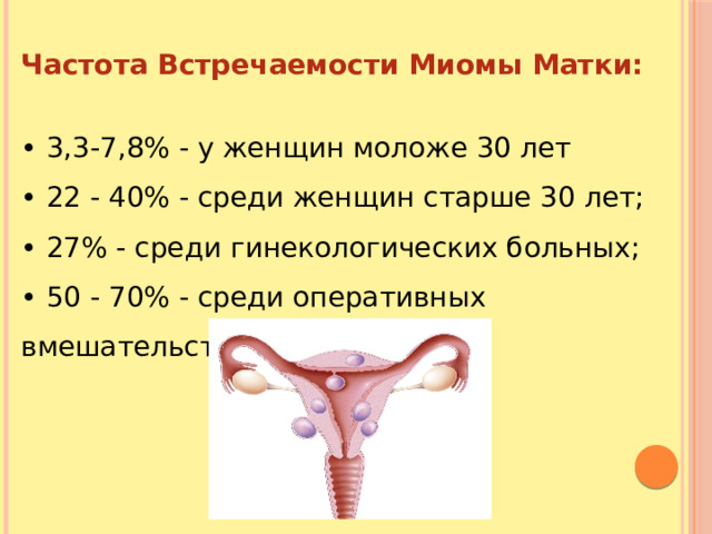 Частота Встречаемости Миомы Матки: • 3,3-7,8% - у женщин моложе 30 лет • 22 - 40% - среди женщин старше 30 лет; • 27% - среди гинекологических больных; • 50 - 70% - среди оперативных вмешательств. 