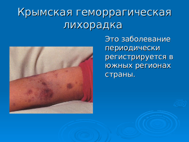 Крымская геморрагическая лихорадка  Это заболевание периодически регистрируется в южных регионах страны. 
